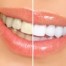 黄色い歯で悩んだら！自宅でできる歯を白くする方法３つ
